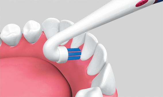 czyszczenie wewnętrznej części łuku zębowego 
